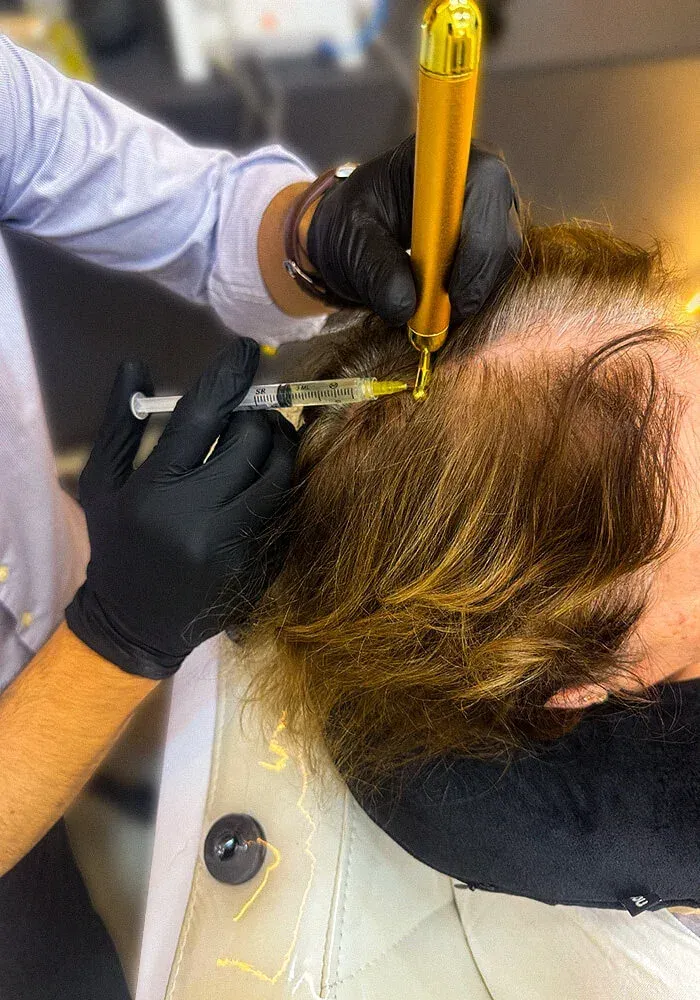 Protocolo clínico para queda de cabelo e calvície no Instituto Venanzi